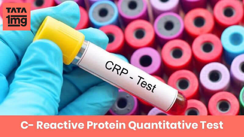 c-reactive-protein-quantitative-crp-purpose-normal-range-of